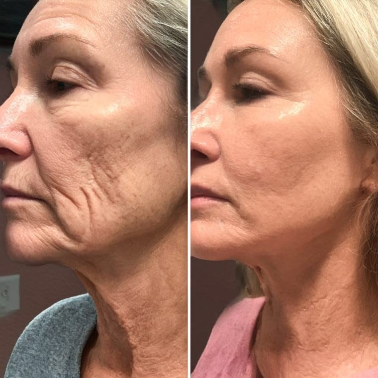 Antes e depois — depoimento 2