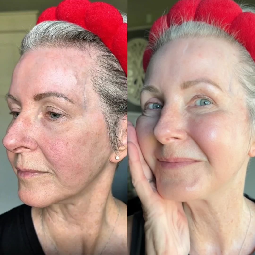 Antes e depois — depoimento 3